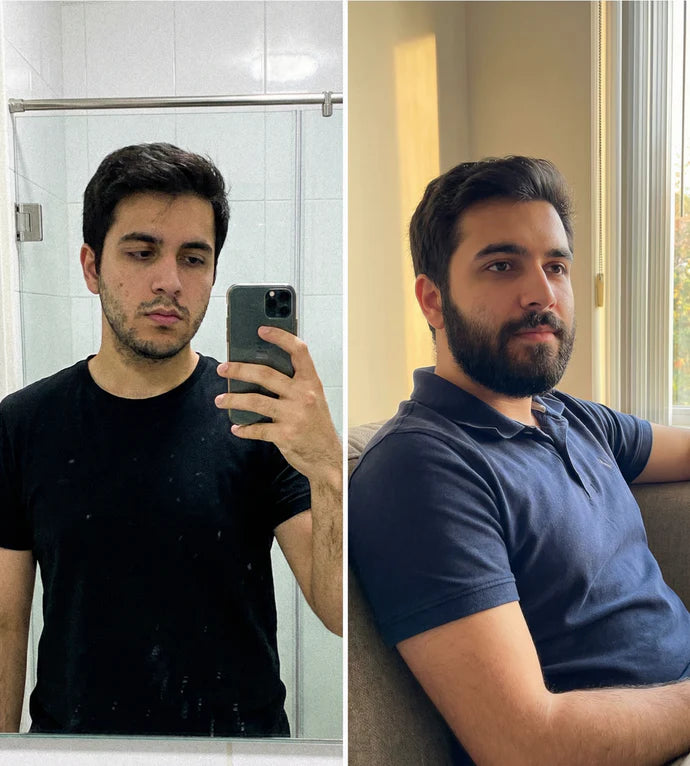 Respaldado por la Ciencia - Antes y Después