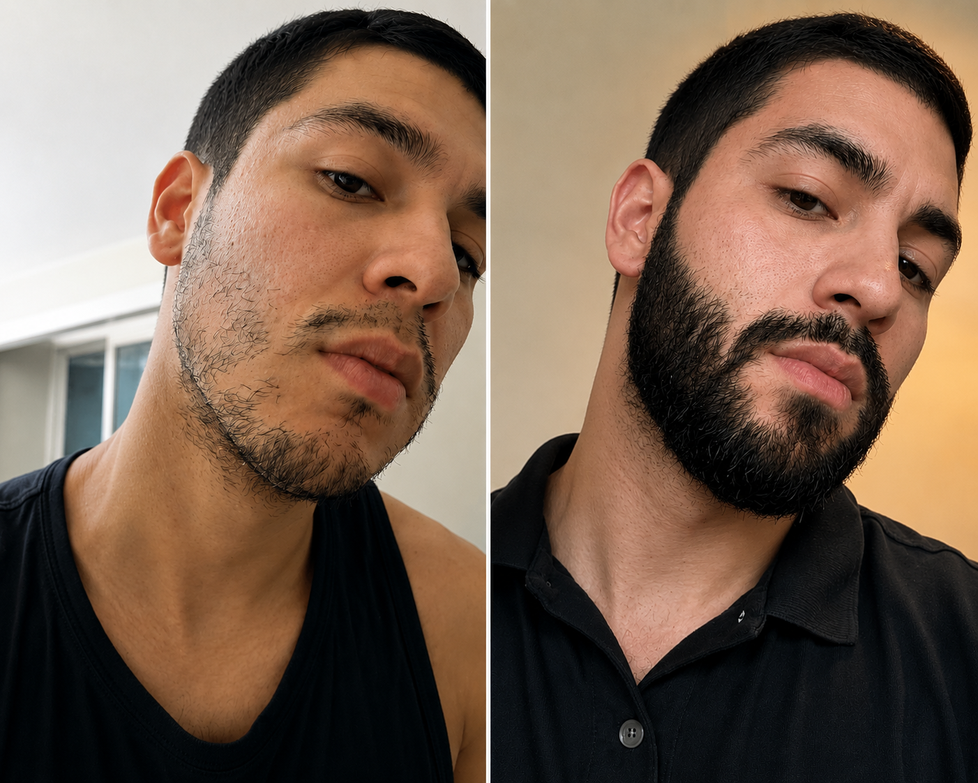 Bálsamo para Crecimiento de Barba Ultra Potente con Minoxidil 20% | 80mL